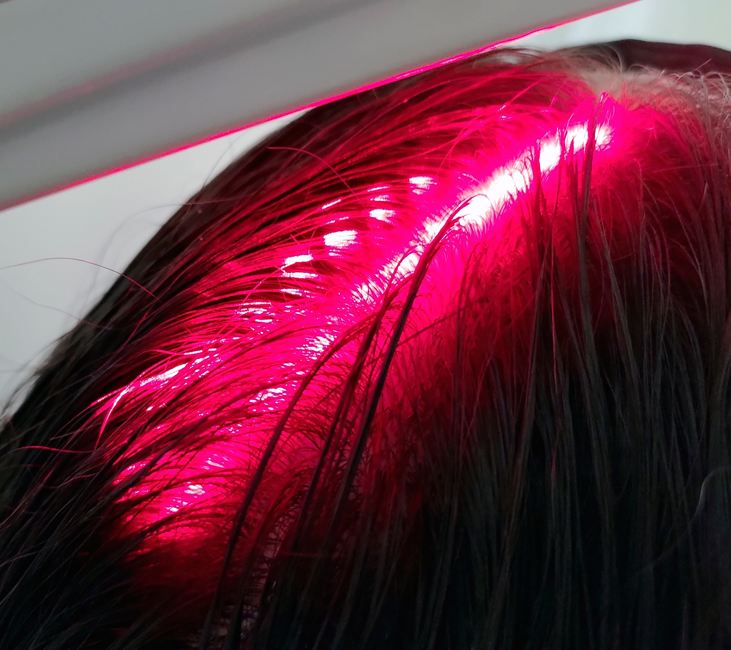 LASER TERAPIA